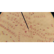 Mitosis en las células de la raíz de una cebolla